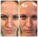Massageador Facial com Fototerapia Anti-Rugas - GlowUp